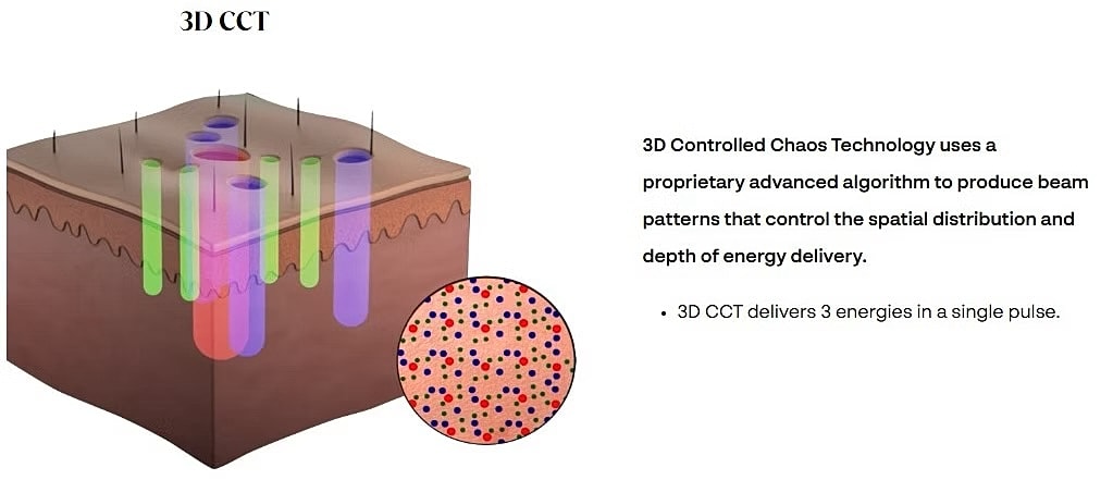 3D CCT technology for energy delivery visualization.