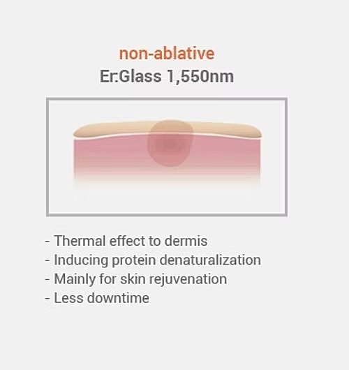 Non-ablative laser treatment for skin rejuvenation.