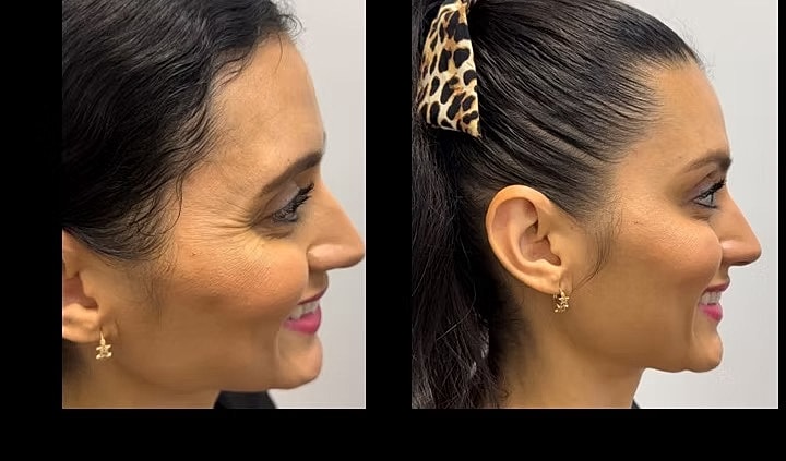Woman with earrings and hair accessories, side profile.
