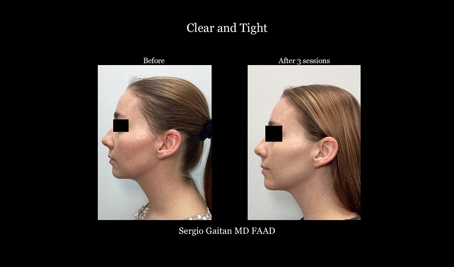 Before and after facial treatment comparison images