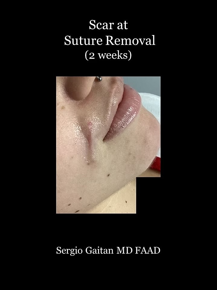 Surgical Dermatology Before & After