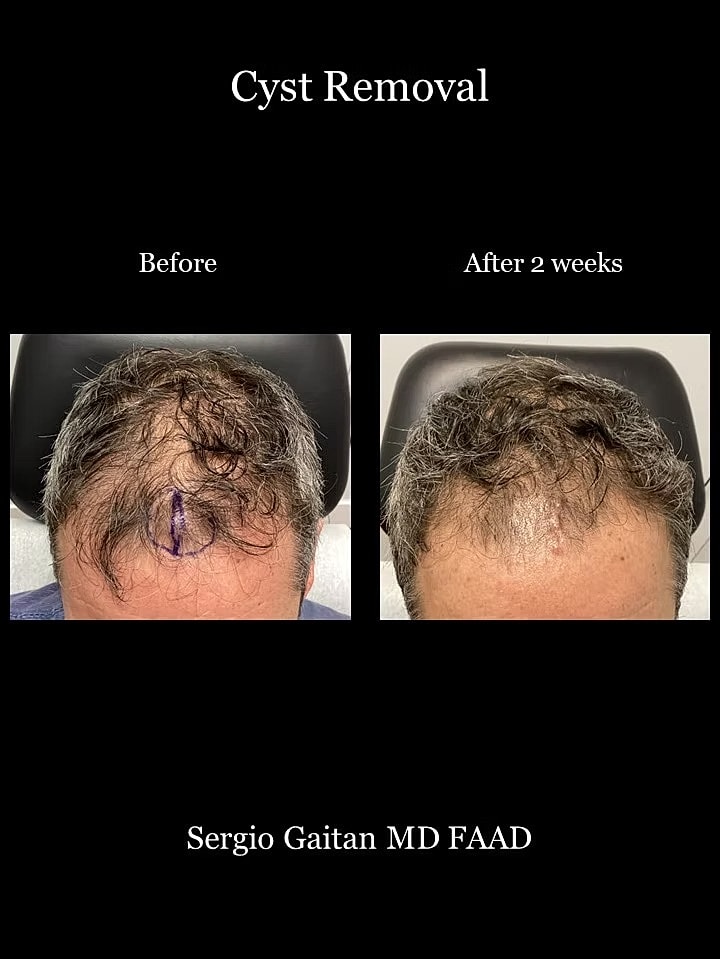 Surgical Dermatology Before & After