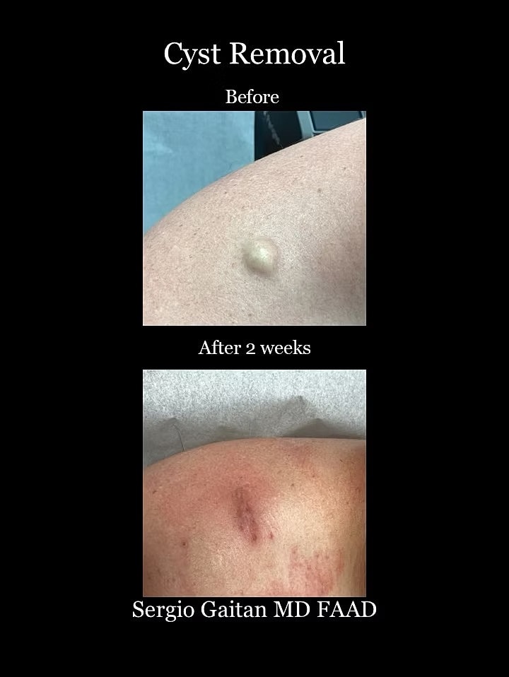 Surgical Dermatology Before & After