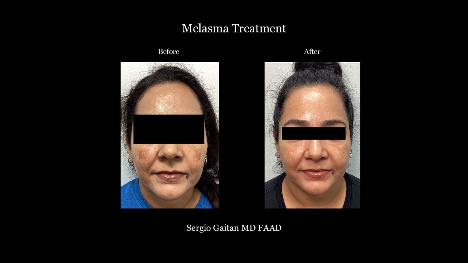 Before & After