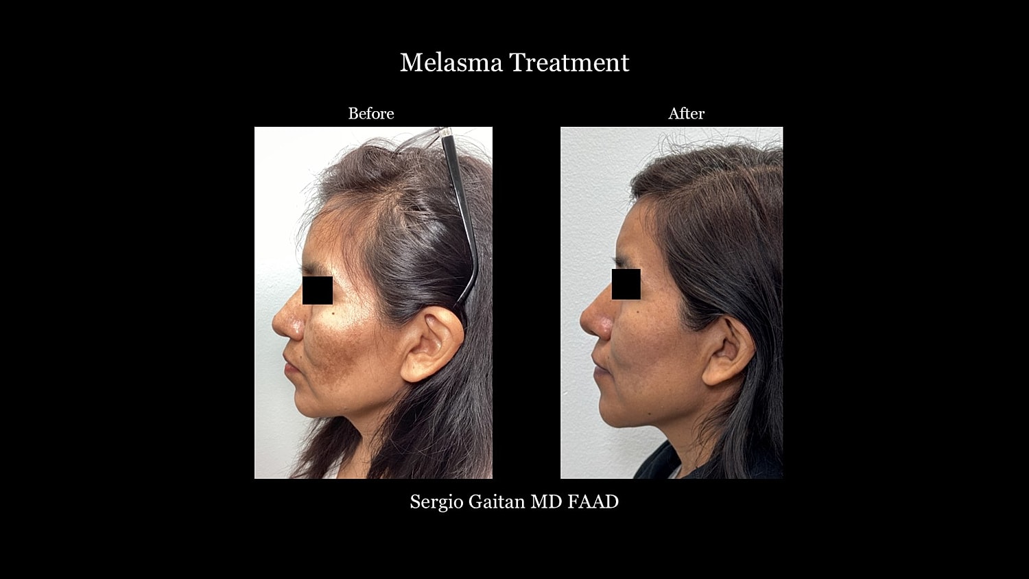Before & After