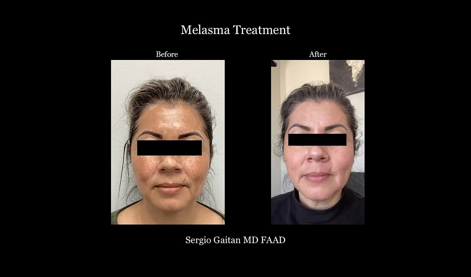 Before & After
