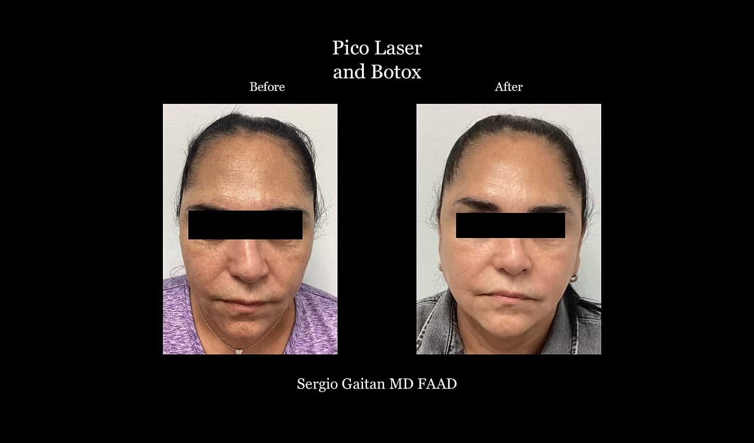 Before & After