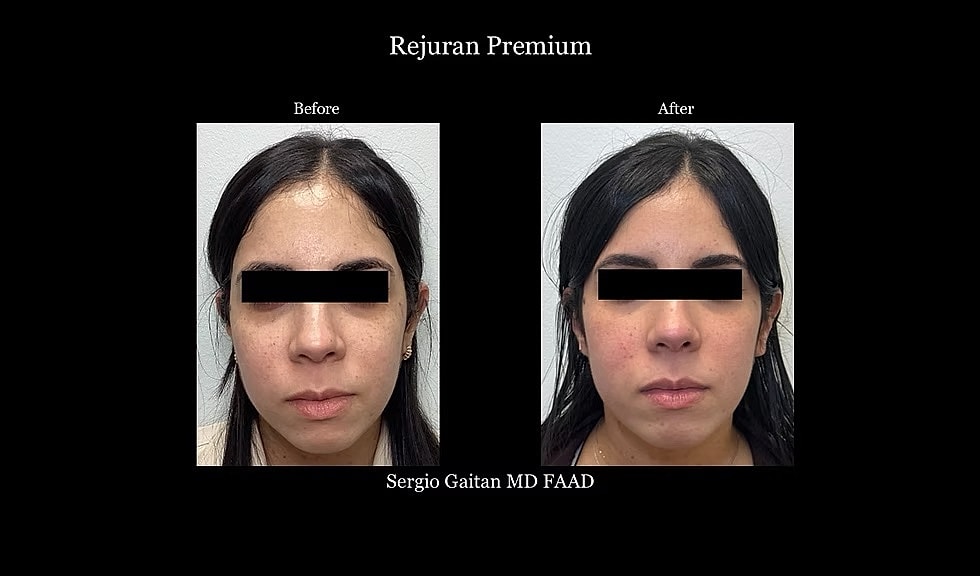 Before & After
